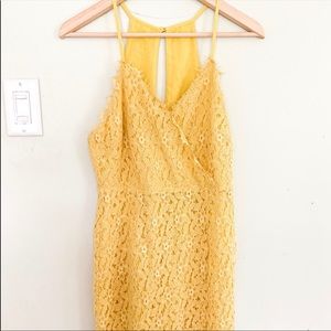 Urban Outfitters Kimchi Blue Scallop Lace Dress